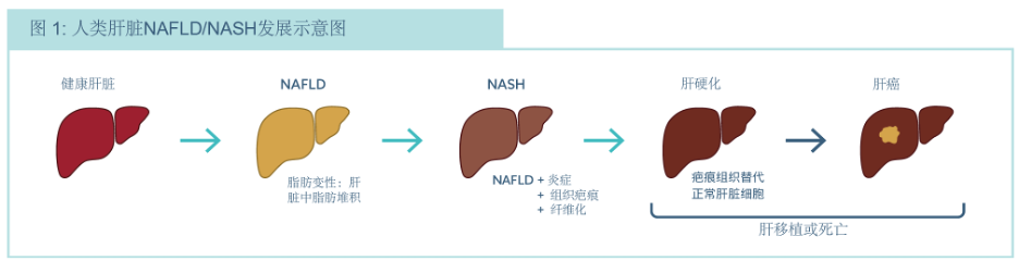 Organ On Chip技術應用|基于人源器官芯片的NASH藥物開發