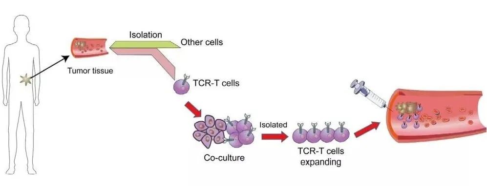 TCR-T比CAR-T更適用于實體瘤治療
