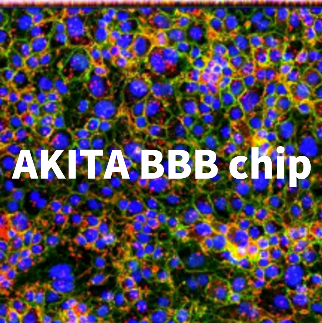 AKITA器官芯片 | iPSC來源的神經類器官&血腦屏障模型