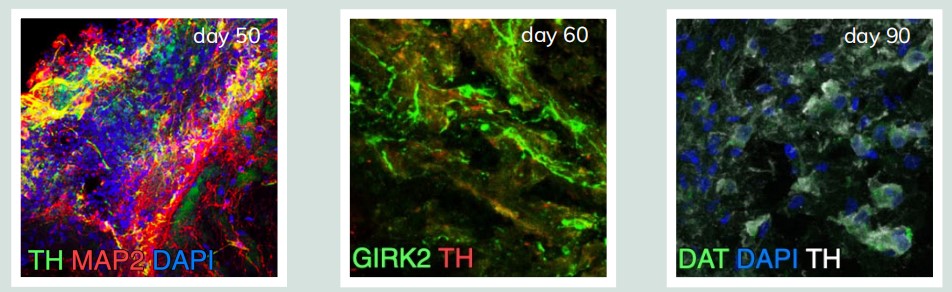 在Biosilk中培養的腦類器官DA神經元可分化成熟